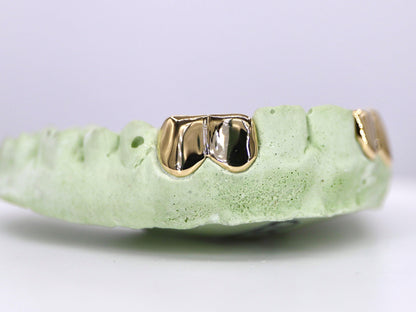 2 Solid Gold Teeth Grillz