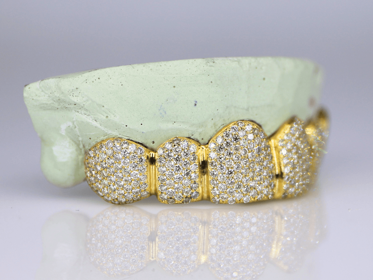 6 on 6 VVS Moissanite Diamond Grillz