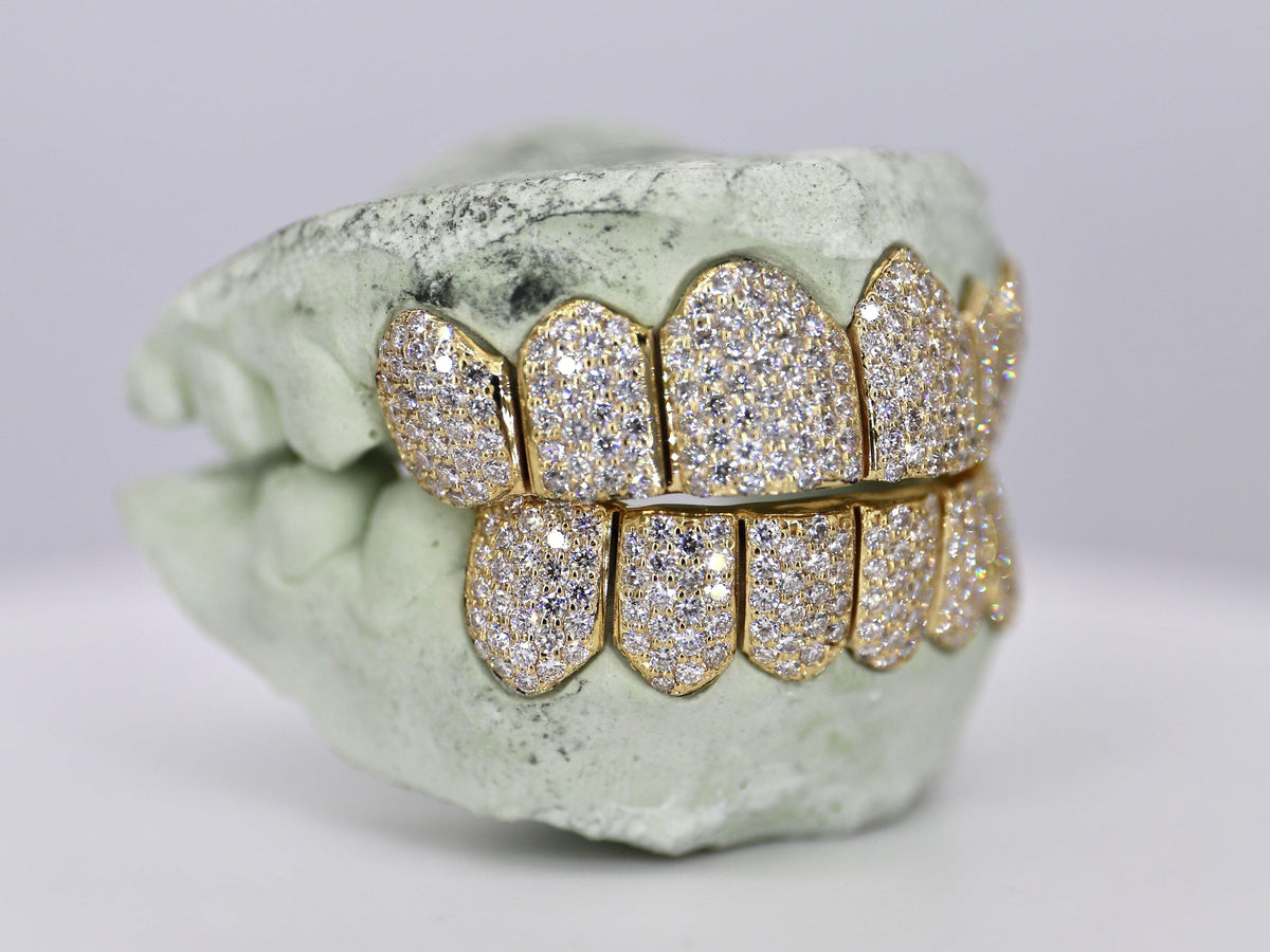 6 on 6 VVS Moissanite Diamond Grillz