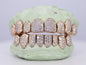 8 on 8 VVS Moissanite Diamond Grillz