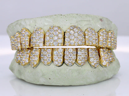 Jumbo VVS Moissanite Diamond Grillz