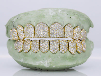 10 on 10 VVS Moisannite Diamond Grillz