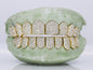 10 on 10 VVS Moisannite Diamond Grillz