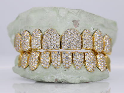 10 on 10 Capped VVS Moisannite Diamond Grillz