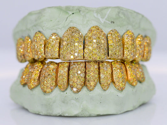 Canary Yellow VVS Moissanite Diamond Grillz