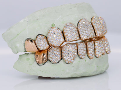 10 on 10 Capped VVS Moisannite Diamond Grillz
