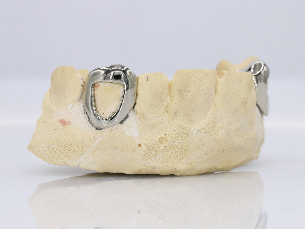 Framed Gold Fangs Grillz