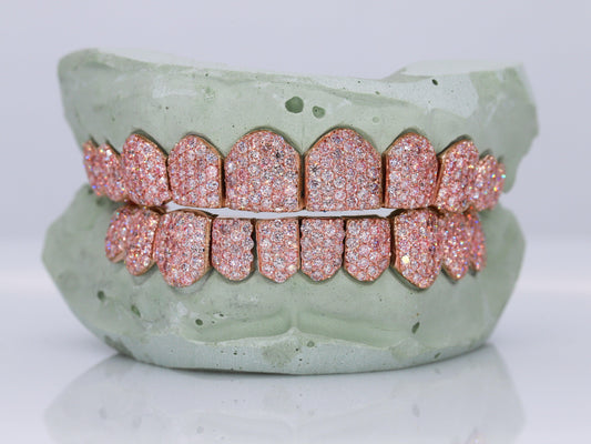 VVS Pink Lab Diamond Grillz