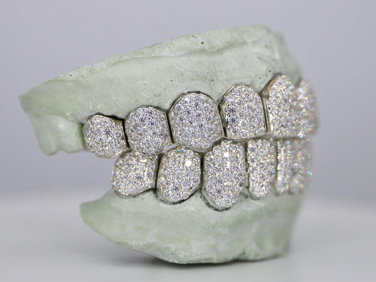 Customizable VVS Moissanite Diamond Grillz