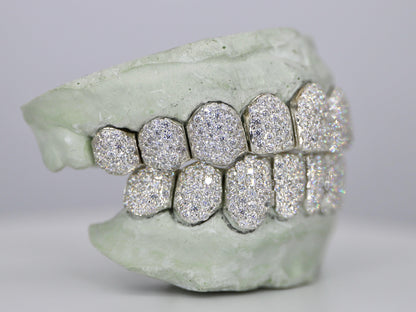 Customizable VVS Moissanite Diamond Grillz