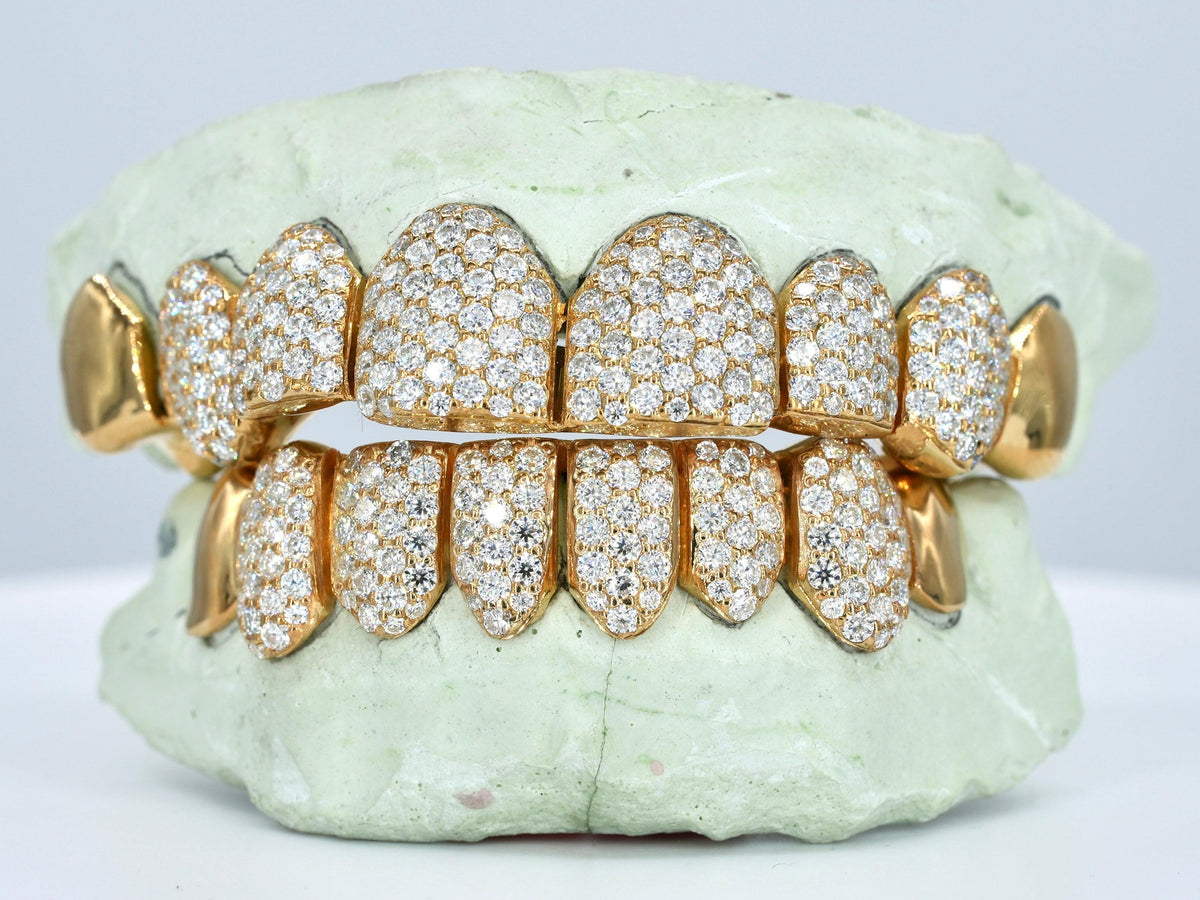 8 on 8 Capped VVS Moissanite Diamond Grillz